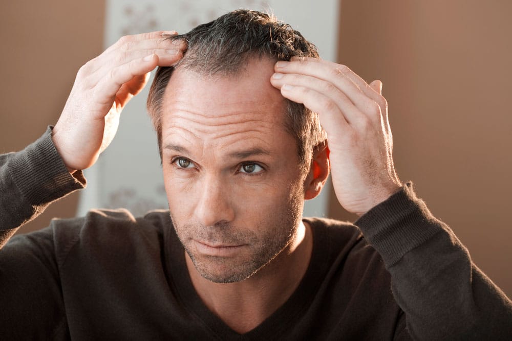 Caida de cabello en hombres