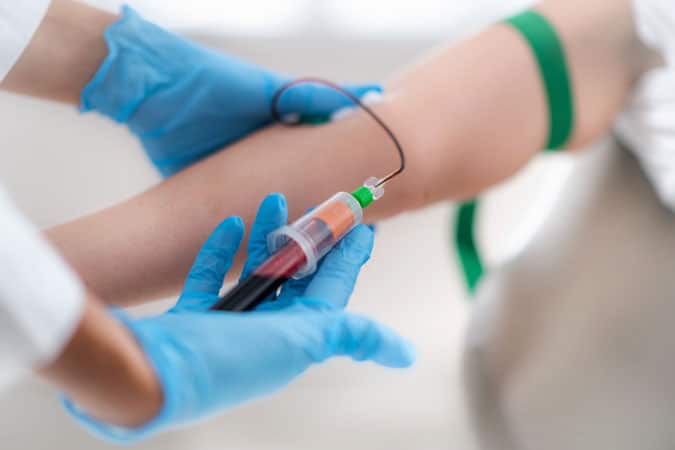 extracción sangre prp capilar