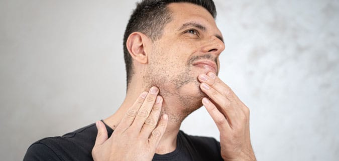 hombre tocandose su barba con calvas