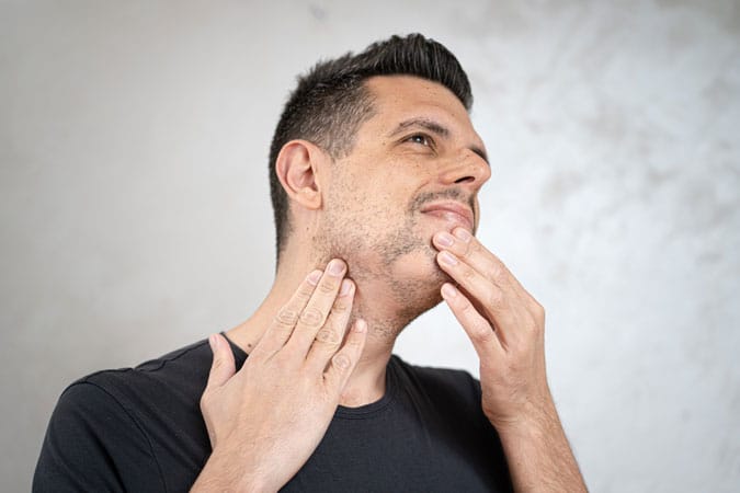 hombre tocandose su barba con calvas